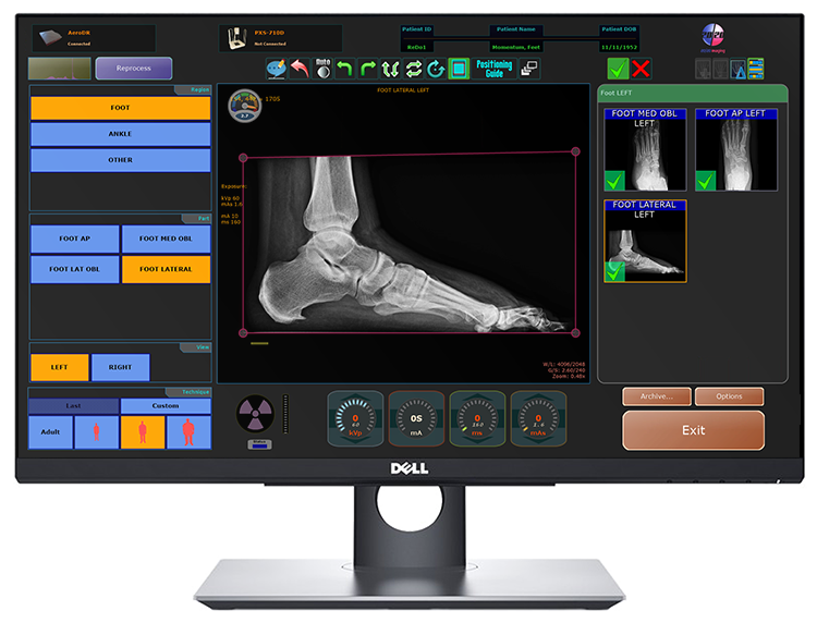 Symmetry-Sync podiatry acquisition — left foot lateral on a 24-inch touchscreen, not a hand exam
