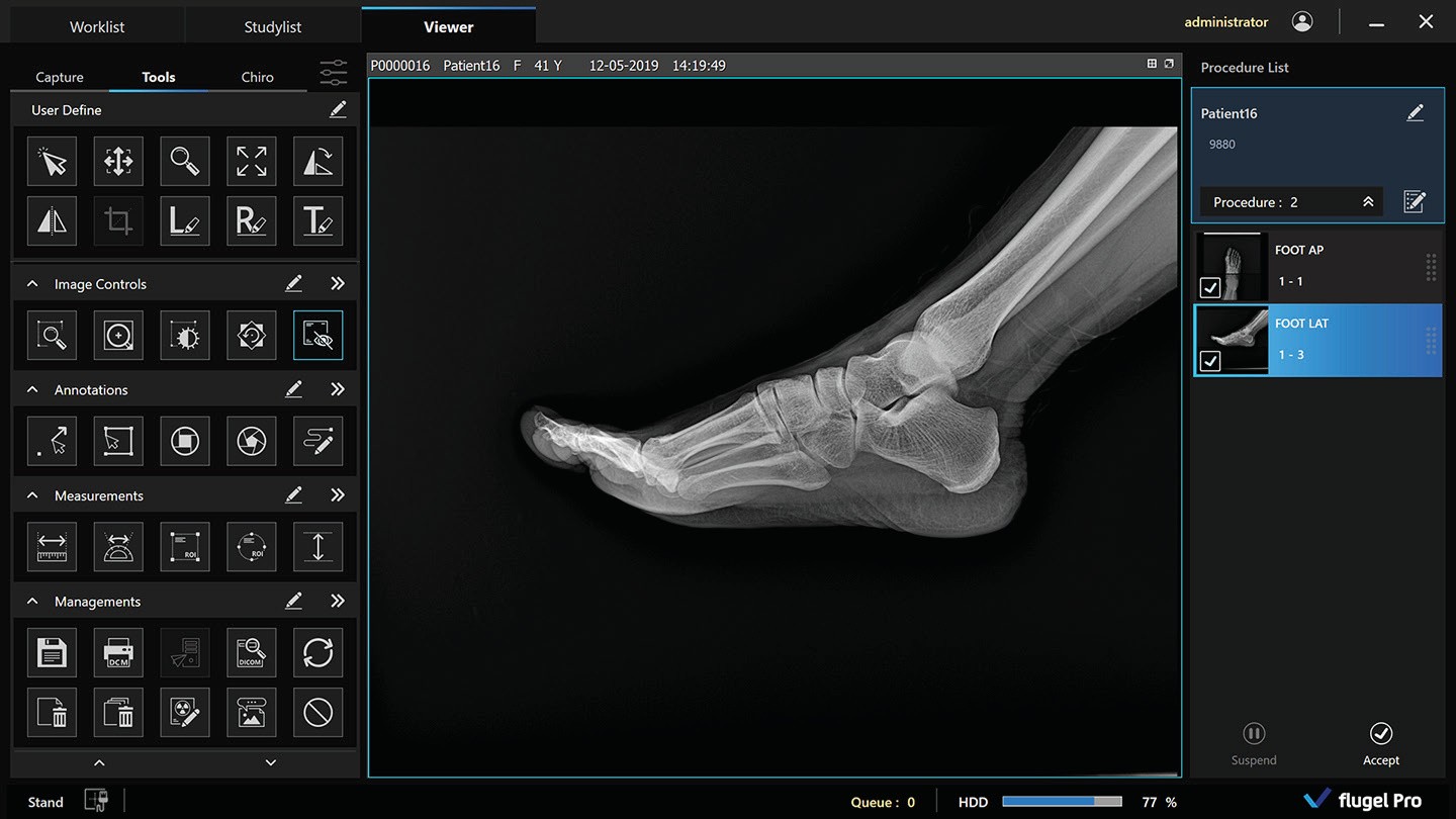 Rayence XCel podiatry room with foot studies on the acquisition monitors